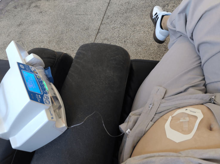 The medication is administered into the abdomen.